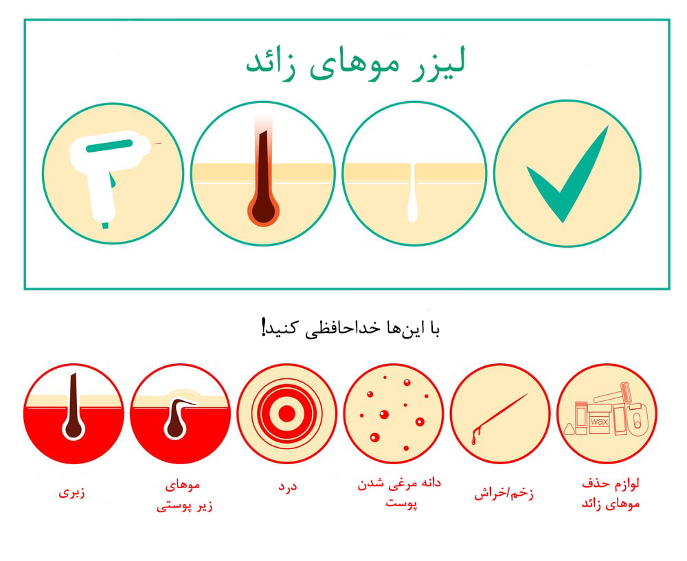 مزایای لیزر موهای زائد